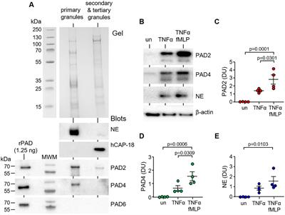 The vacuolar anti-Pseudomonal activity of neutrophil primary granule peptidyl-arginine deiminase enzymes